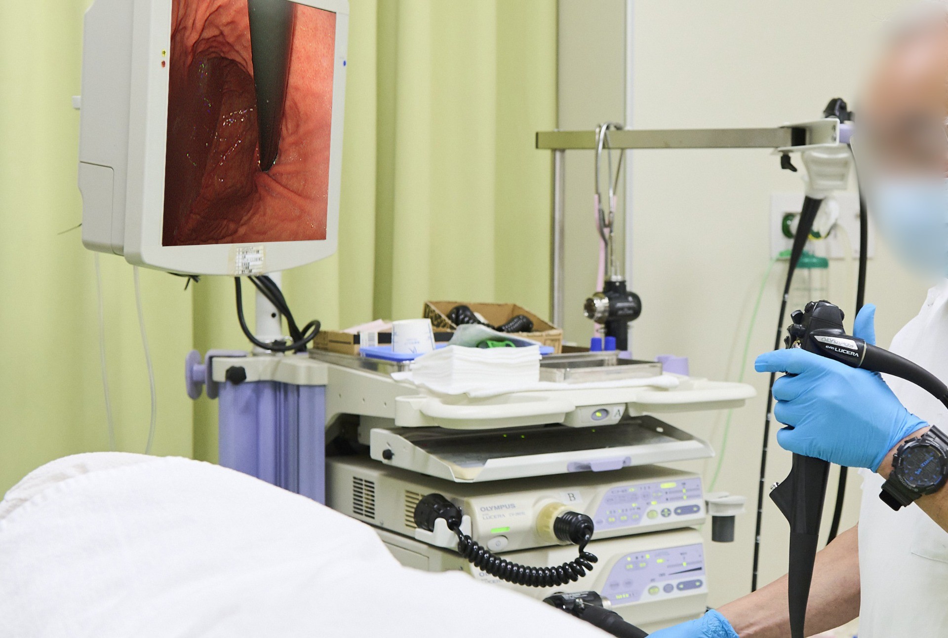 胃の痛みが続く方へ。内視鏡検査（胃カメラ）の特徴を紹介